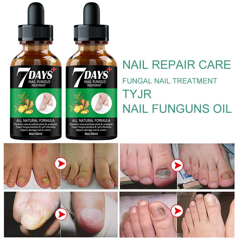 7DAYS Repair Nail Fungus