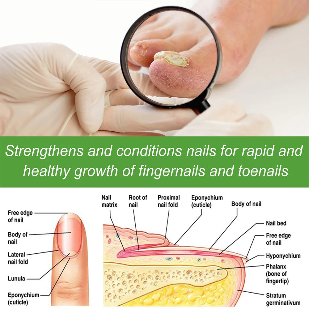 7DAYS Repair Nail Fungus