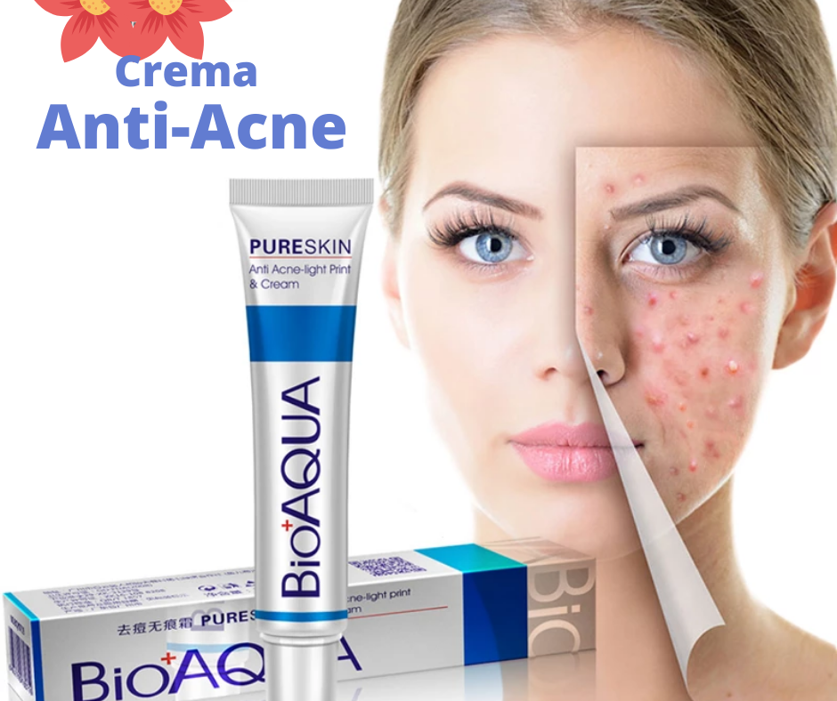 x2 crema actiacne