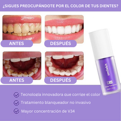 Blanqueador SmileKit Dental™ - TRENDFINDER®